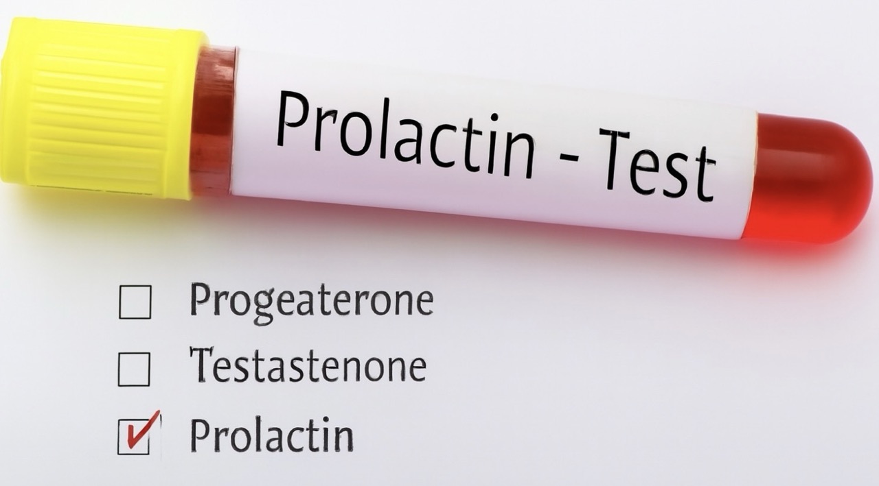 Jakie są objawy nadmiaru prolaktyny? Sprawdź przyczyny, normy i skuteczne sposoby leczenia hiperprolaktynemii u kobiet i mężczyzn.