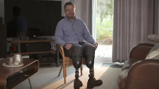 Brytyjski chirurg Neil Hopper spędzi 2 lata i 8 miesięcy w więzieniu za fałszywe amputacje i oszustwa ubezpieczeniowe opiewające na setki tysięcy funtów.