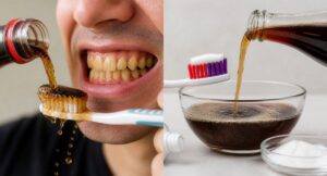 Jak cola wpływa na zęby? Dowiedz się wszystkiego o erozji szkliwa, czyszczeniu Coca-Colą i o tym, dlaczego mieszanie pasty z sodą jest groźne dla zdrowia jamy ustnej